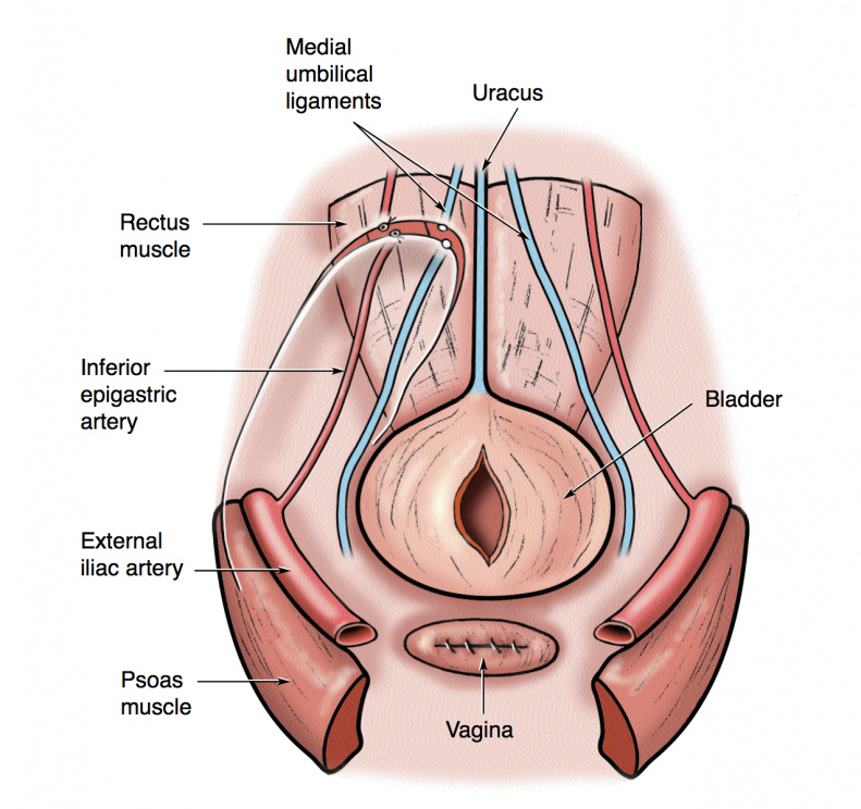 Vaginal Tightening And Rejuvenation Naturally For Android